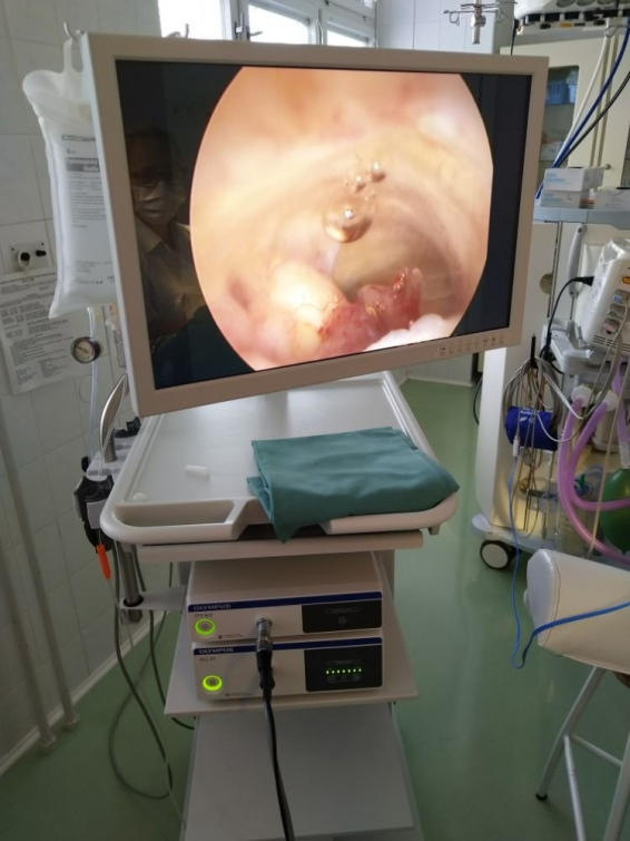 Nový hysteroskop zpřesní diagnostiku a zkrátí pobyt pacientek ve Vsetínské nemocnici
