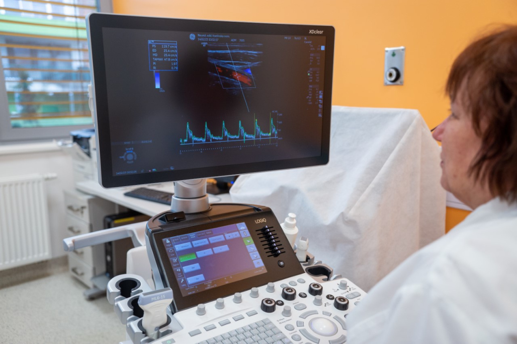 Vsetínská nemocnice pořídila další špičkové ultrazvuky