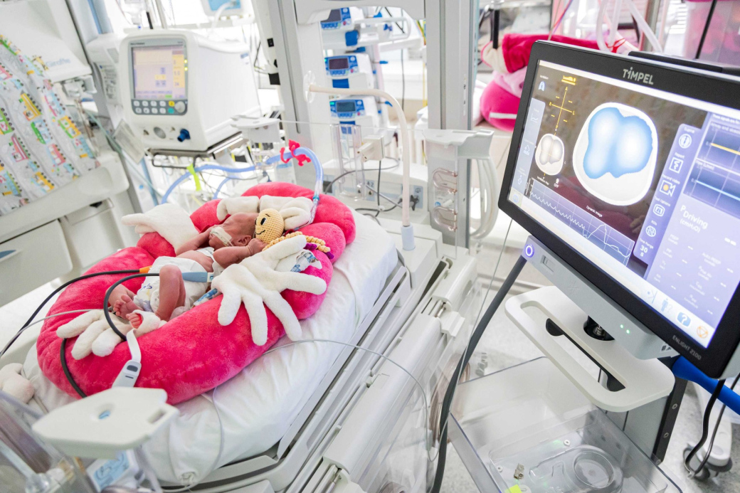 Zlínská neonatologie má další celorepublikovou novinku – přístroj TIMPEL