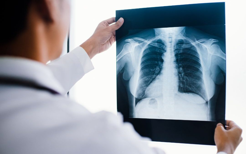 Fakulta technologická UTB bude nově vyučovat obor Radiologický asistent