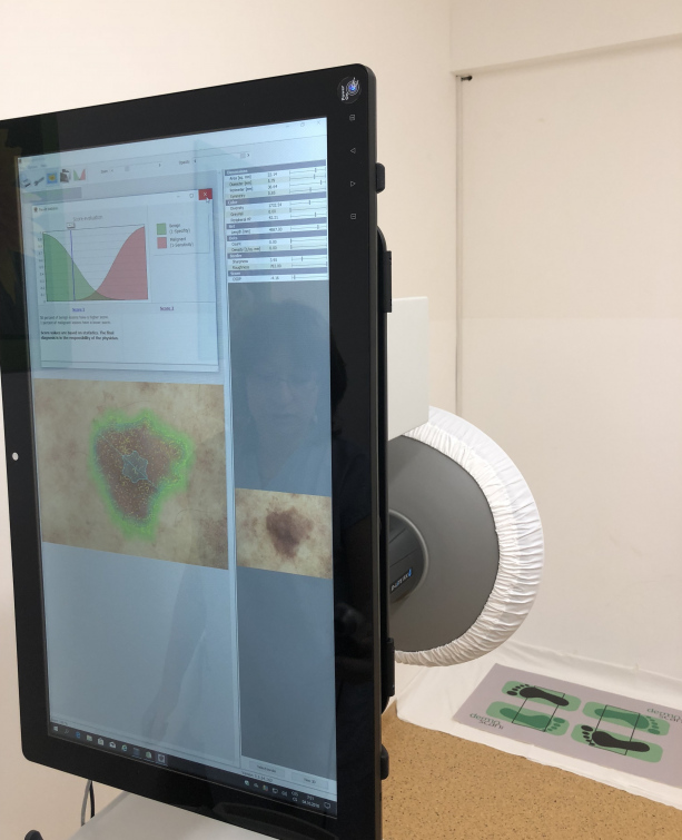 Krajská nemocnice má nejmodernější digitální dermatoskop  
