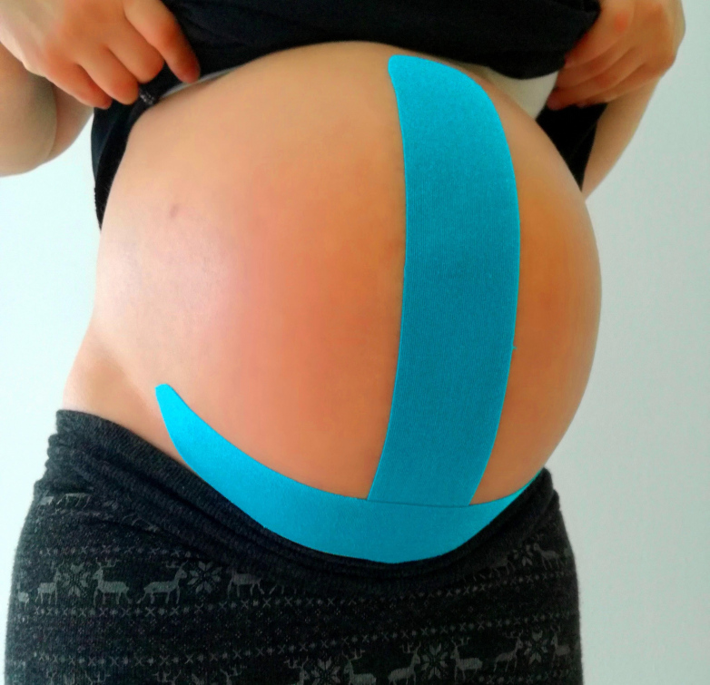 Těhotným ženám a maminkám ulevuje od bolesti v Nemocnici Valašské Meziříčí kinesiotaping
