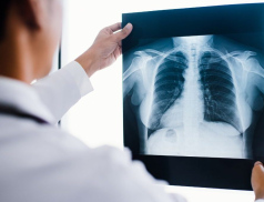 Fakulta technologická UTB bude nově vyučovat obor Radiologický asistent