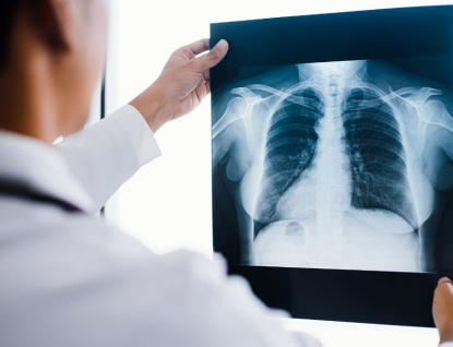 Fakulta technologická UTB bude nově vyučovat obor Radiologický asistent