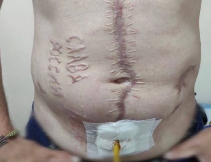Na těle vypálený nápis. Šokovaný lékař zveřejnil fotku vojáka, který se vrátil z ruského zajetí