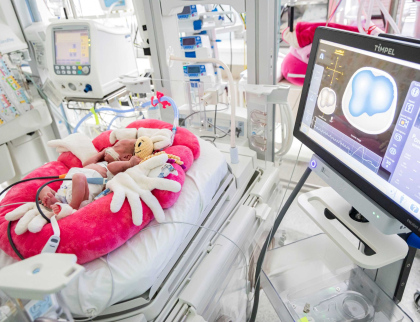 Zlínská neonatologie má další celorepublikovou novinku – přístroj TIMPEL