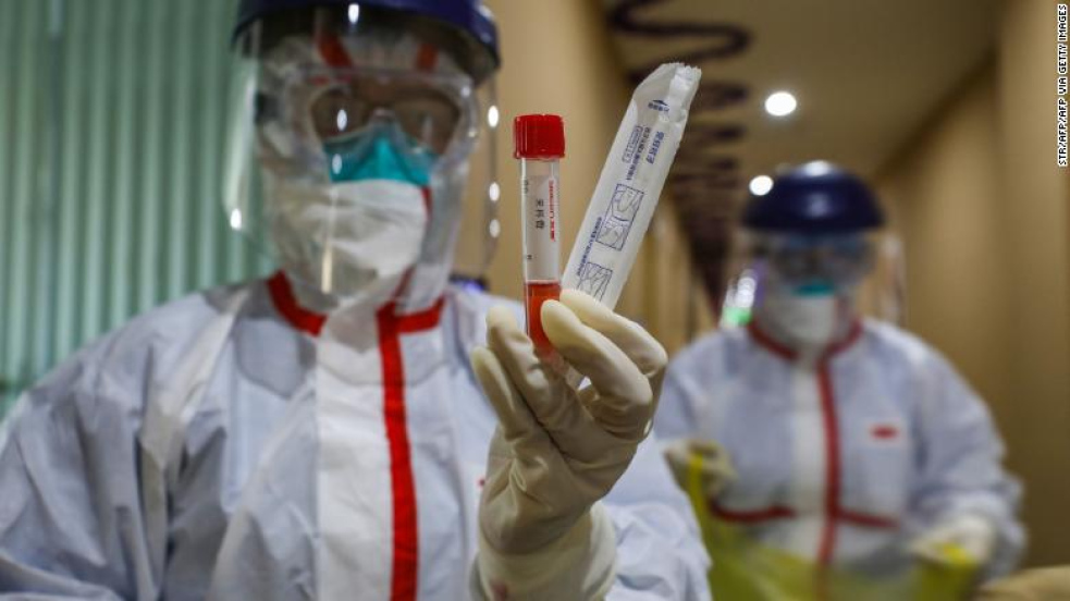 Vědci ve Wu-chanu dělali s koronavirem absolutní šílenosti, tvrdí přední ruský mikrobiolog